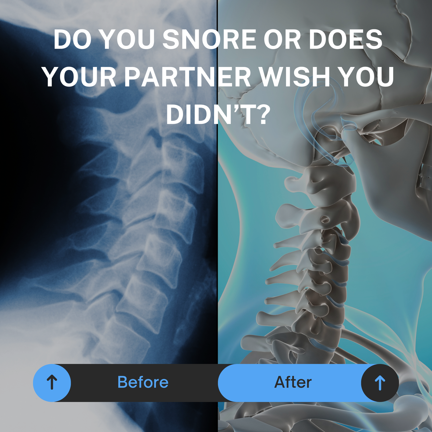 Twiia - Anti Snore Neck Support