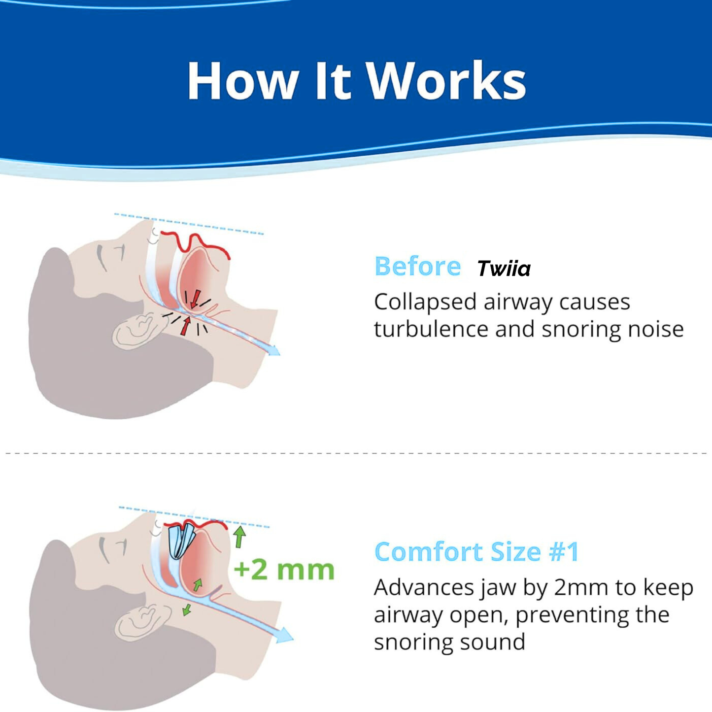 NEW 24Quiet® Anti Snoring Mouth Guard