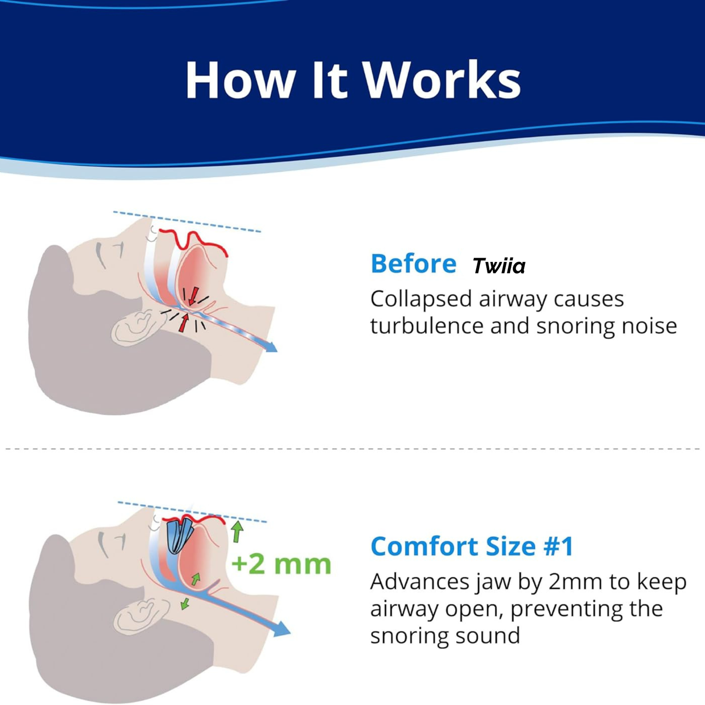 NEW 24Quiet® Anti Snoring Mouth Guard
