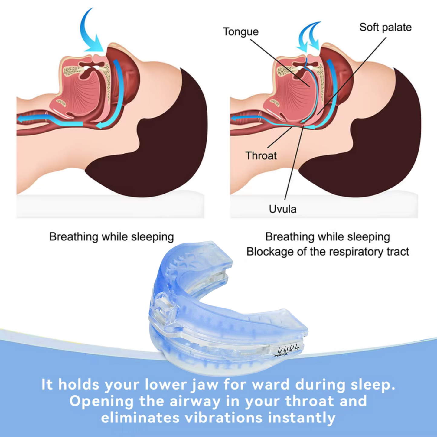 NEW 24Quiet® Anti Snoring Mouth Guard