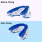 24Quiet® Anti Snoring Mouth Guard