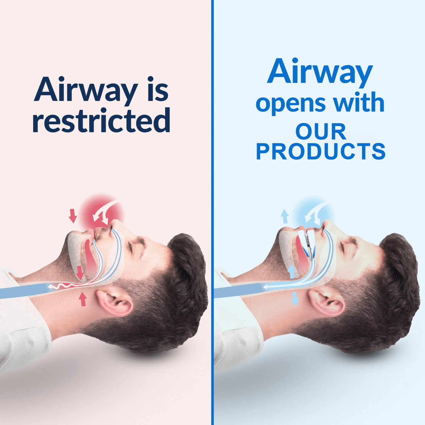 24Quiet® Anti Snoring Mouth Guard