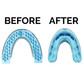 24Quiet® Anti Snoring Mouth Guard